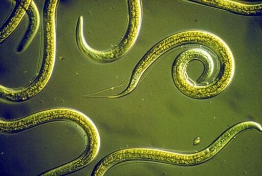Vermes nematodos parasitarios no intestino delgado humano
